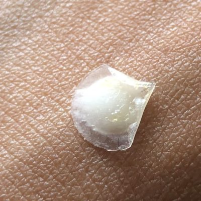 Healthy Bod. Co Hydrocolloid Pimple Patches x 36 Patches, Bye Bye Blemishes - Image 4