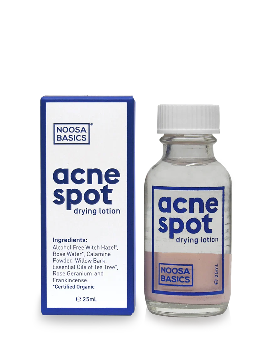 Noosa Basics Fast Acting Acne Spot Drying Lotion 25mL, Alcohol Free